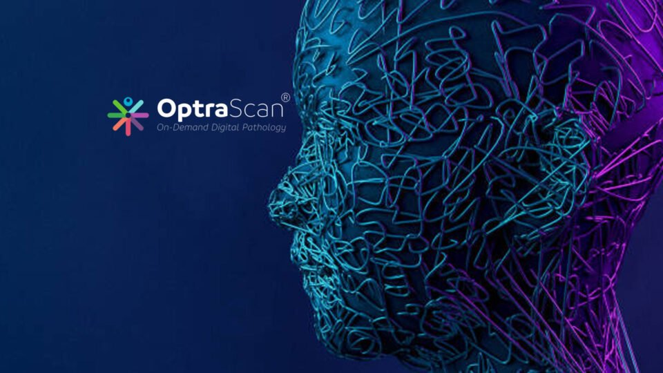 OptraSCAN