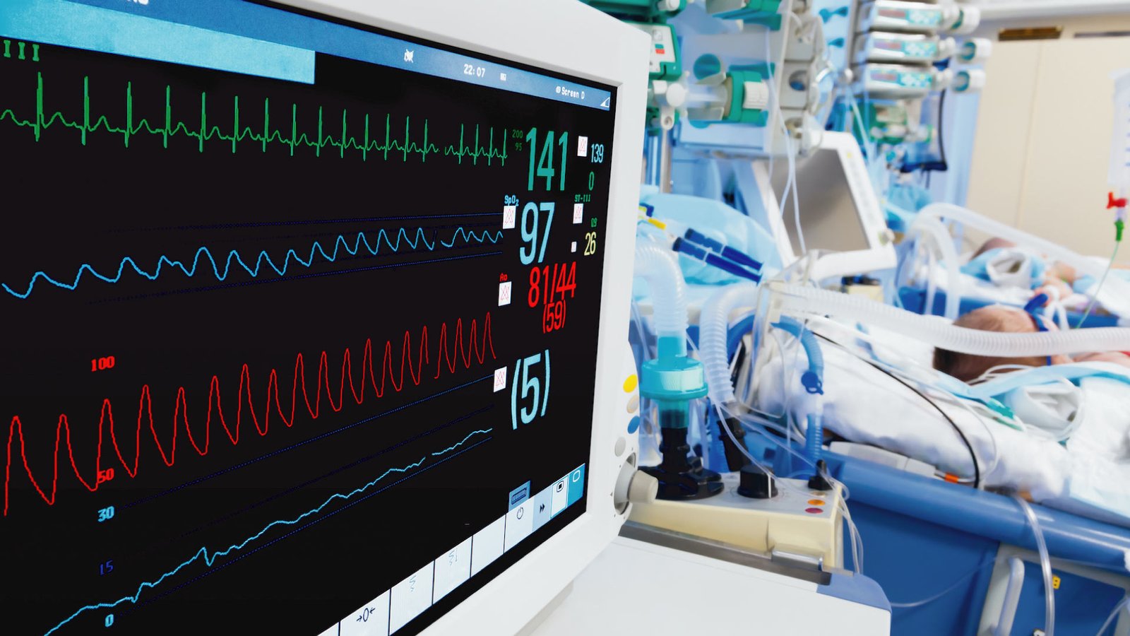 Patient Monitoring